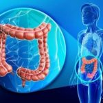 10 MODURI DE A IMBUNATATI SANATATEA INTESTINELOR